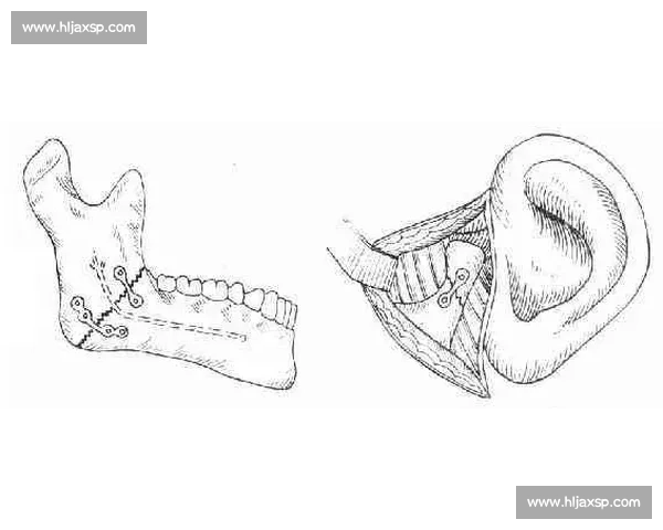 萨尔瓦多带伤复诊：鼻骨骨折伤情追踪